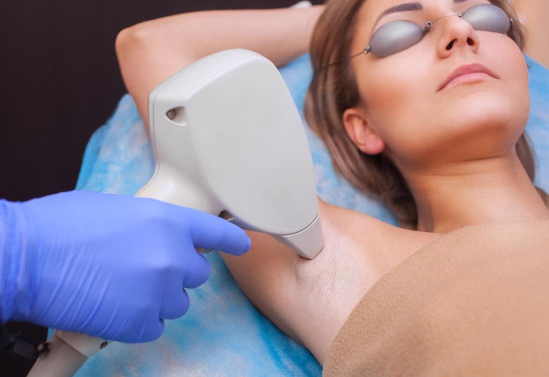 Laser hair reduction at Skin Pixel